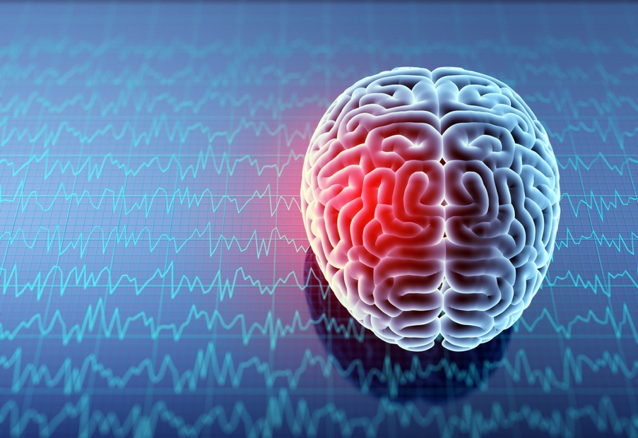 Understanding Traumatic Brain Injuries (TBI) from Car Accidents